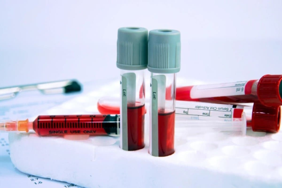 kan-tahlillerimiz-bize-ne-anlatiyor